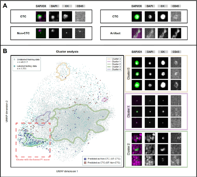 Figure 3 for Cluster-based human-in-the-loop strategy for improving machine learning-based circulating tumor cell detection in liquid biopsy