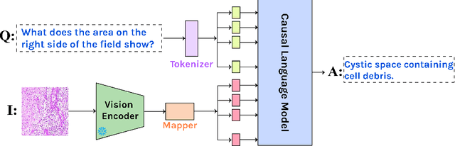 Figure 1 for Open-Ended Medical Visual Question Answering Through Prefix Tuning of Language Models