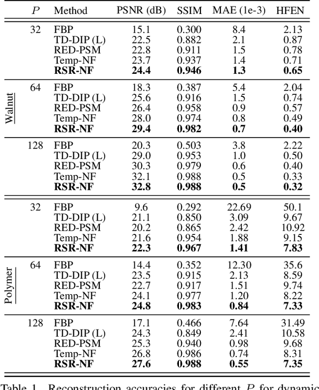 Figure 2 for RSR-NF: Neural Field Regularization by Static Restoration Priors for Dynamic Imaging