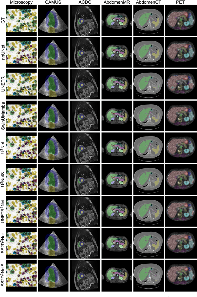 Figure 4 for From Claims to Evidence: A Unified Framework and Critical Analysis of CNN vs. Transformer vs. Mamba in Medical Image Segmentation