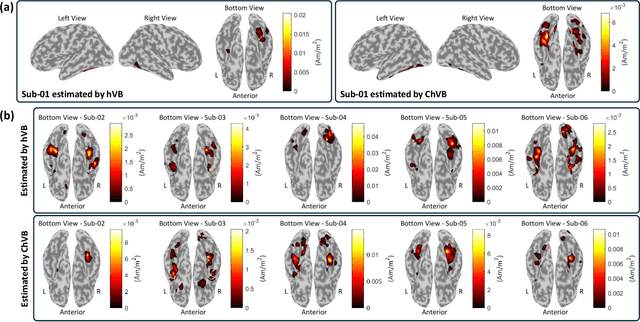 Figure 4 for Correntropy-Based Improper Likelihood Model for Robust Electrophysiological Source Imaging