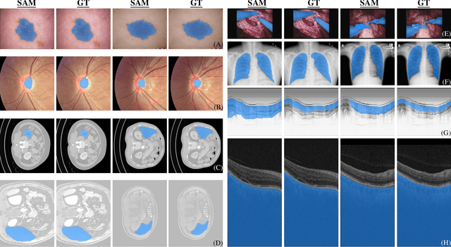 Figure 2 for Generalist Vision Foundation Models for Medical Imaging: A Case Study of Segment Anything Model on Zero-Shot Medical Segmentation