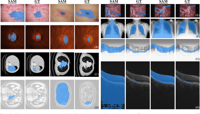 Figure 4 for Generalist Vision Foundation Models for Medical Imaging: A Case Study of Segment Anything Model on Zero-Shot Medical Segmentation