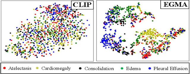 Figure 4 for Eye-gaze Guided Multi-modal Alignment Framework for Radiology