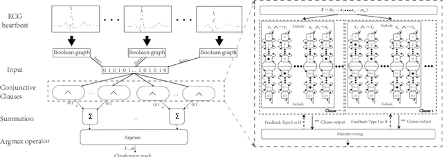 Figure 4 for Interpretable Tsetlin Machine-based Premature Ventricular Contraction Identification