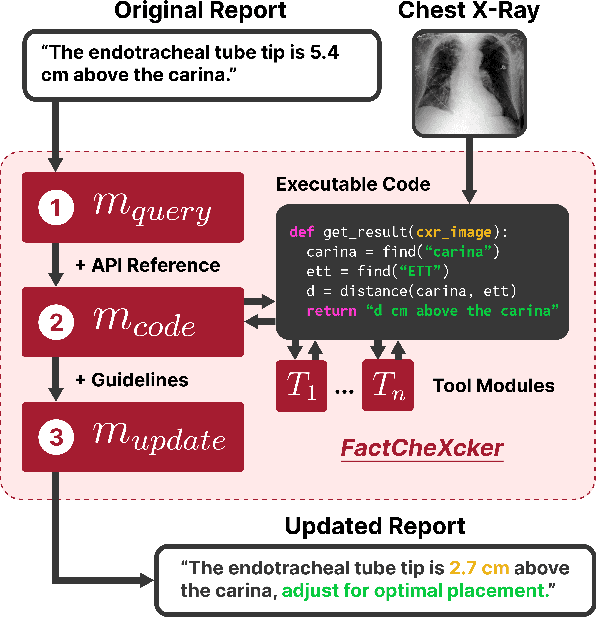 Figure 1 for FactCheXcker: Mitigating Measurement Hallucinations in Chest X-ray Report Generation Models