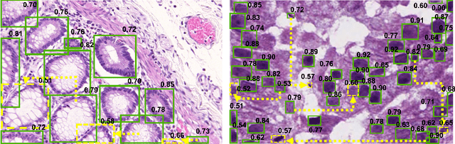 Figure 1 for TSBP: Improving Object Detection in Histology Images via Test-time Self-guided Bounding-box Propagation