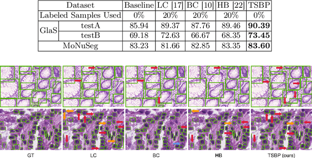 Figure 2 for TSBP: Improving Object Detection in Histology Images via Test-time Self-guided Bounding-box Propagation