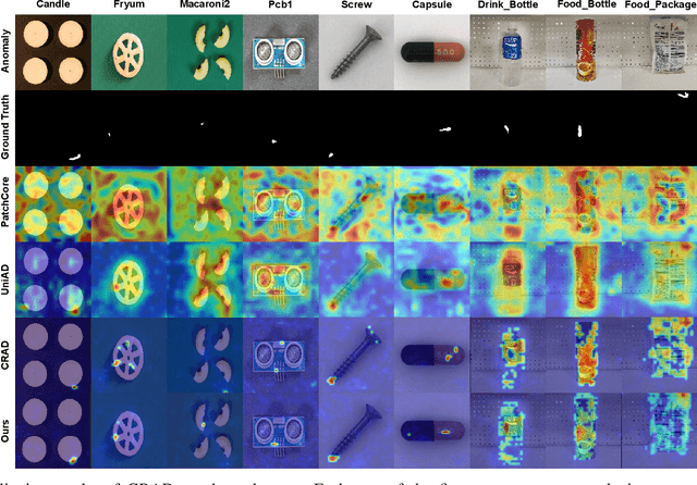 Figure 4 for Bi-Grid Reconstruction for Image Anomaly Detection