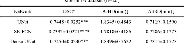 Figure 4 for AtlasSeg: Atlas Prior Guided Dual-U-Net for Cortical Segmentation in Fetal Brain MRI