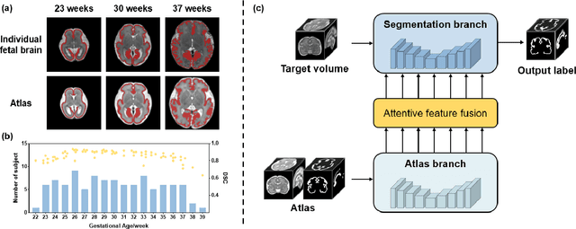 Figure 1 for AtlasSeg: Atlas Prior Guided Dual-U-Net for Cortical Segmentation in Fetal Brain MRI