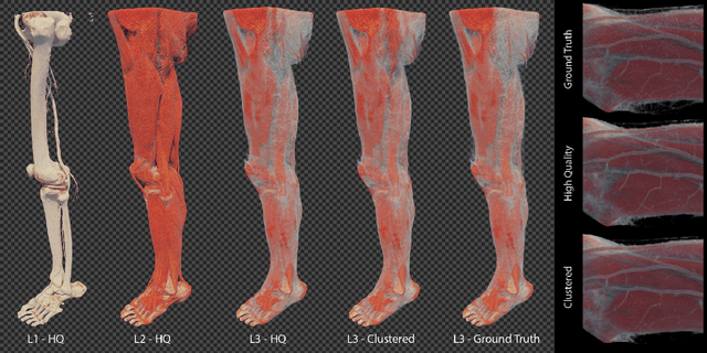 Figure 2 for Multi-Layer Gaussian Splatting for Immersive Anatomy Visualization