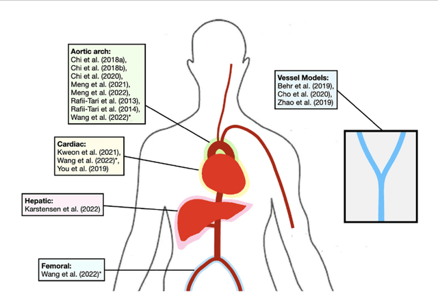 Figure 4 for Artificial Intelligence in the Autonomous Navigation of Endovascular Interventions: A Systematic Review