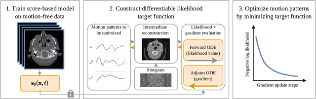 Figure 1 for Differentiable Score-Based Likelihoods: Learning CT Motion Compensation From Clean Images