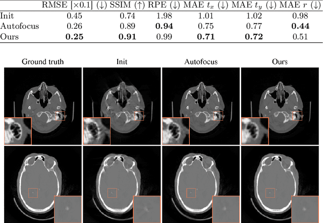 Figure 2 for Differentiable Score-Based Likelihoods: Learning CT Motion Compensation From Clean Images