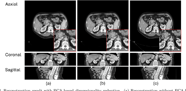 Figure 4 for Compressibility Analysis for the differentiable shift-variant Filtered Backprojection Model