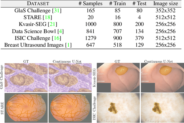 Figure 3 for Continuous U-Net: Faster, Greater and Noiseless