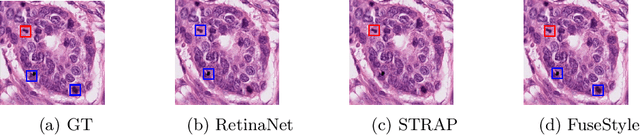 Figure 3 for Histopathological Image Analysis with Style-Augmented Feature Domain Mixing for Improved Generalization