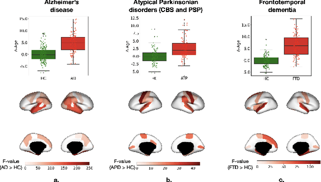 Figure 3 for Explainable Brain Age Gap Prediction in Neurodegenerative Conditions using coVariance Neural Networks