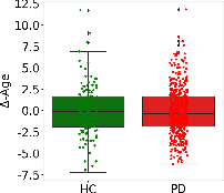 Figure 4 for Explainable Brain Age Gap Prediction in Neurodegenerative Conditions using coVariance Neural Networks