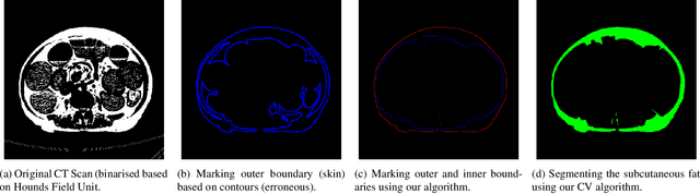 Figure 3 for Bridging the Diagnostic Divide: Classical Computer Vision and Advanced AI methods for distinguishing ITB and CD through CTE Scans