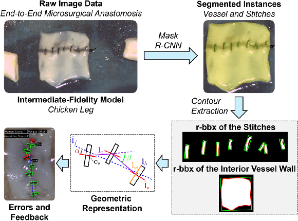 Figure 1 for Quantitative Outcome-Oriented Assessment of Microsurgical Anastomosis