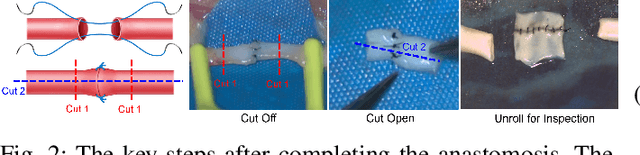 Figure 2 for Quantitative Outcome-Oriented Assessment of Microsurgical Anastomosis