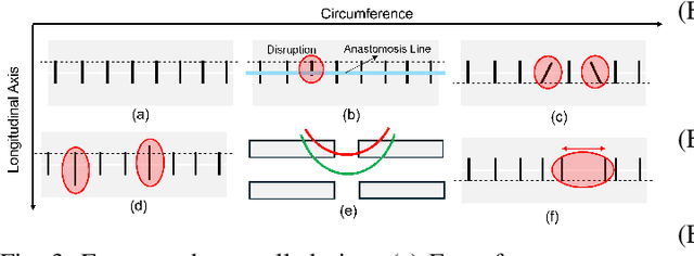 Figure 3 for Quantitative Outcome-Oriented Assessment of Microsurgical Anastomosis
