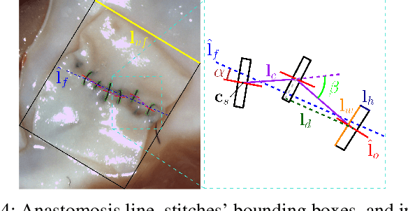 Figure 4 for Quantitative Outcome-Oriented Assessment of Microsurgical Anastomosis
