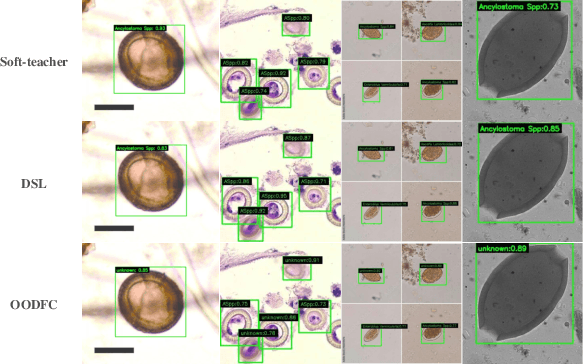 Figure 1 for Class-balanced Open-set Semi-supervised Object Detection for Medical Images