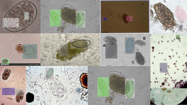 Figure 3 for Class-balanced Open-set Semi-supervised Object Detection for Medical Images