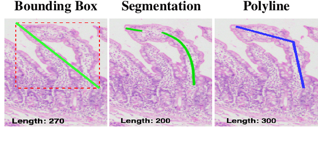 Figure 1 for MeasureNet: Measurement Based Celiac Disease Identification