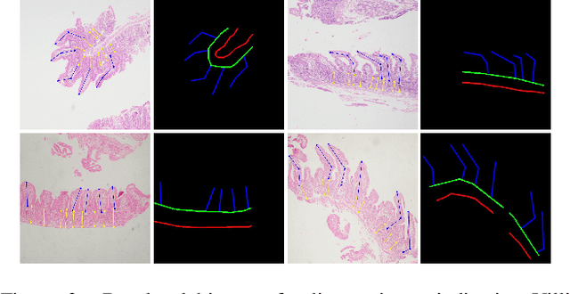 Figure 3 for MeasureNet: Measurement Based Celiac Disease Identification