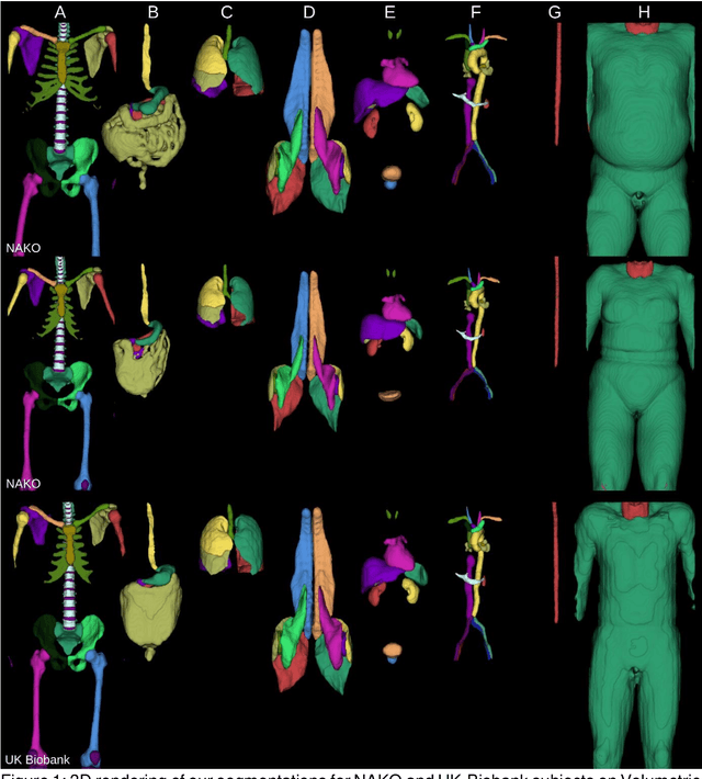 Figure 1 for TotalVibeSegmentator: Full Torso Segmentation for the NAKO and UK Biobank in Volumetric Interpolated Breath-hold Examination Body Images