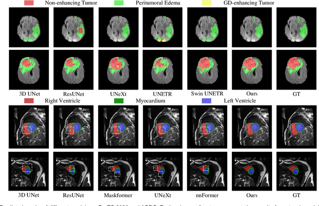 Figure 4 for Learning with Explicit Shape Priors for Medical Image Segmentation