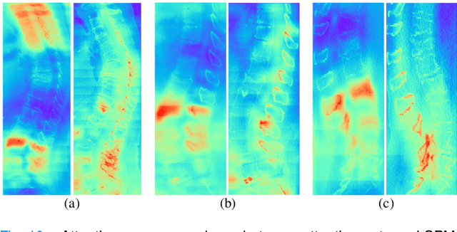 Figure 2 for Learning with Explicit Shape Priors for Medical Image Segmentation