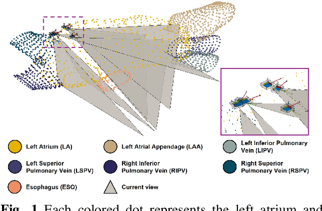 Figure 1 for Pose Estimation for Intra-cardiac Echocardiography Catheter via AI-Based Anatomical Understanding