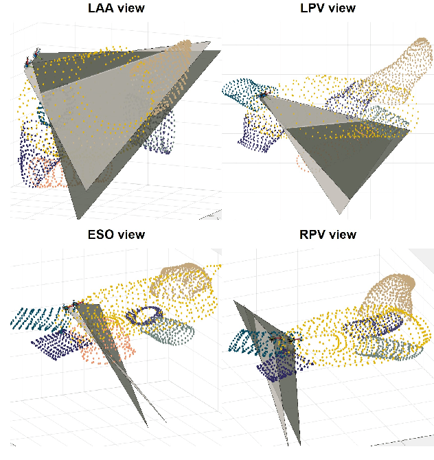 Figure 3 for Pose Estimation for Intra-cardiac Echocardiography Catheter via AI-Based Anatomical Understanding