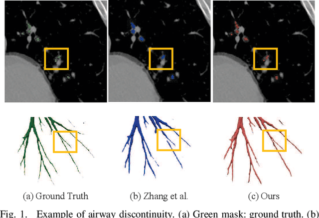 Figure 1 for Multi-Stage Airway Segmentation in Lung CT Based on Multi-scale Nested Residual UNet