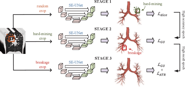Figure 2 for Multi-Stage Airway Segmentation in Lung CT Based on Multi-scale Nested Residual UNet
