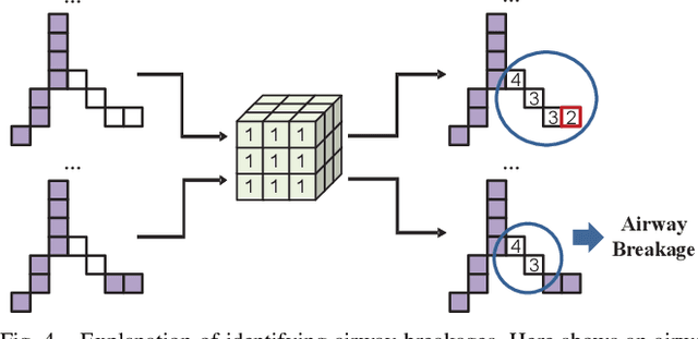 Figure 4 for Multi-Stage Airway Segmentation in Lung CT Based on Multi-scale Nested Residual UNet