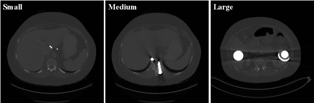 Figure 3 for RetinexFlow for CT metal artifact reduction