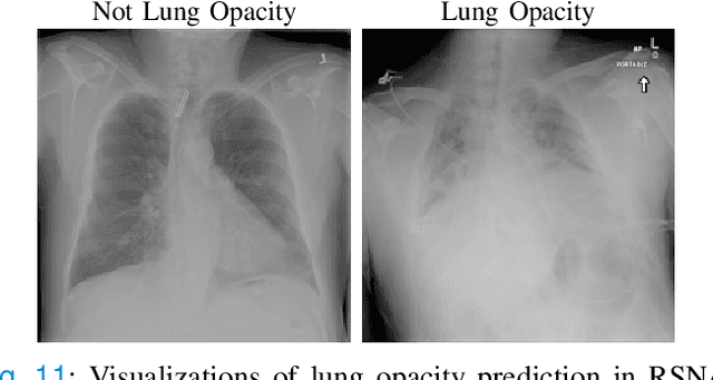 Figure 3 for Pre-training on High Definition X-ray Images: An Experimental Study