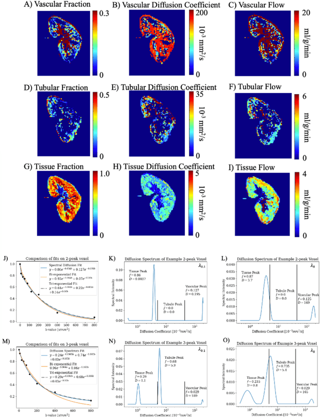 Figure 4 for Quantification of Multi-Compartment Flow with Spectral Diffusion MRI