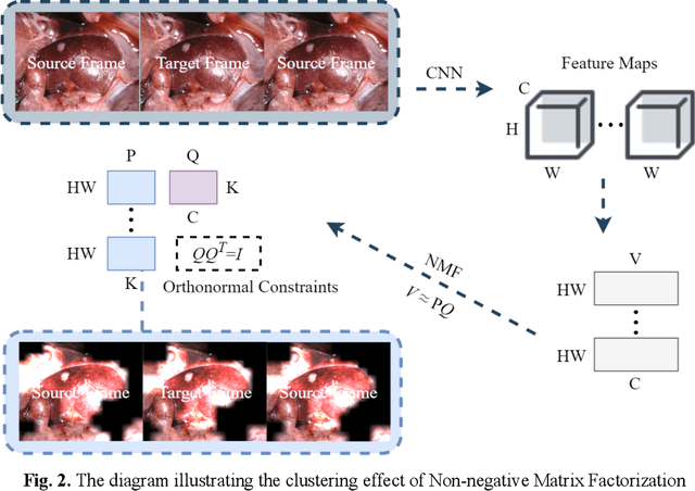 Figure 3 for Occlusion-Aware Self-Supervised Monocular Depth Estimation for Weak-Texture Endoscopic Images