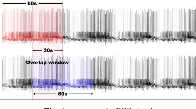 Figure 1 for MobileNetV2: A lightweight classification model for home-based sleep apnea screening