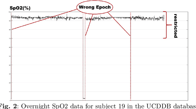 Figure 3 for MobileNetV2: A lightweight classification model for home-based sleep apnea screening