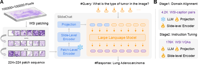 Figure 3 for SlideChat: A Large Vision-Language Assistant for Whole-Slide Pathology Image Understanding