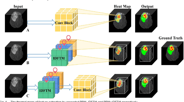 Figure 1 for 3D Brainformer: 3D Fusion Transformer for Brain Tumor Segmentation