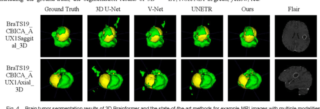 Figure 4 for 3D Brainformer: 3D Fusion Transformer for Brain Tumor Segmentation